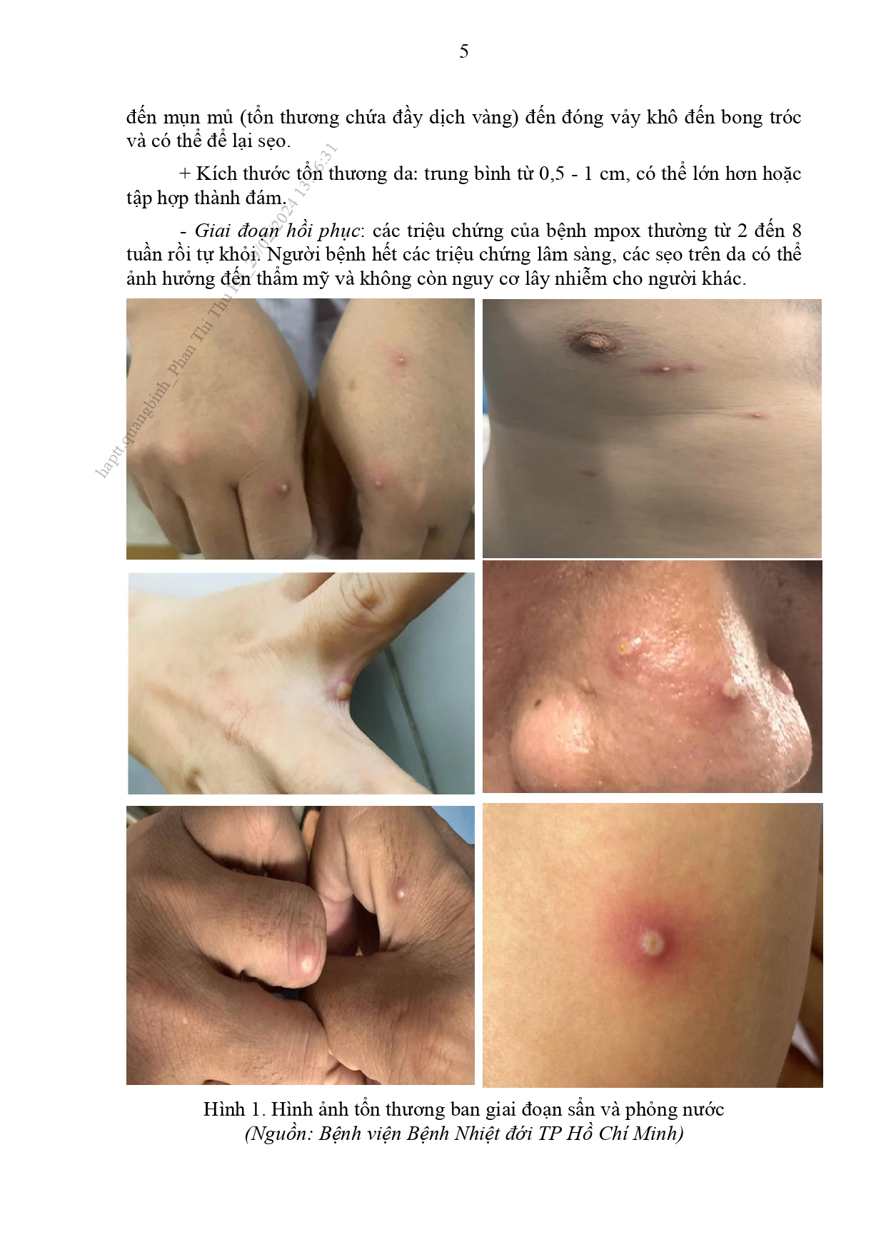 Huong-dan-chan-doan-dau-mua-khi_page-0006.jpg