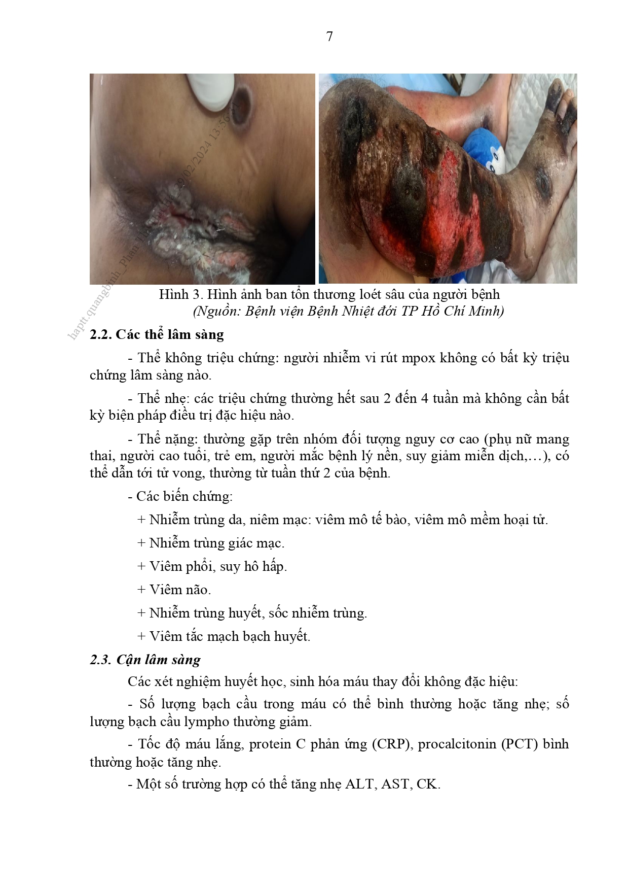 Huong-dan-chan-doan-dau-mua-khi_page-0008.jpg